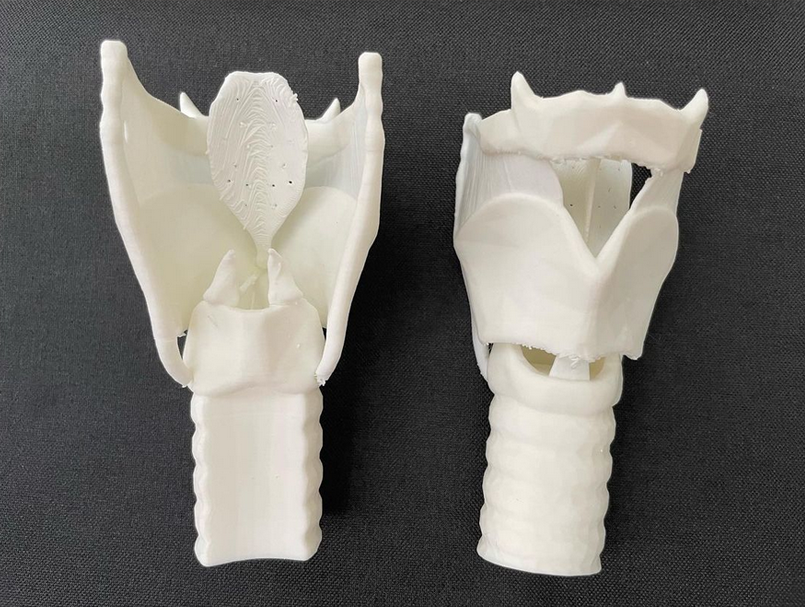 3d-Printed Larynx produced in a March RLML Makerspace Workshop for Anesthesiologist students.