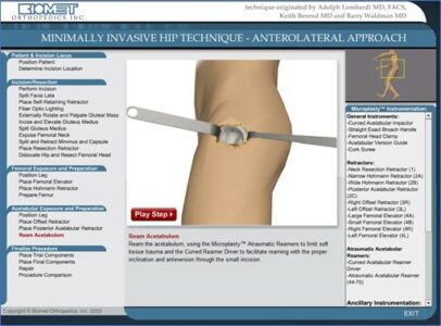 Biomet Orthopedics, Inc. interactive surgical simulation of a minimally invasive anterolateral approach technique for total hip replacement (rlml-005-er-000011)